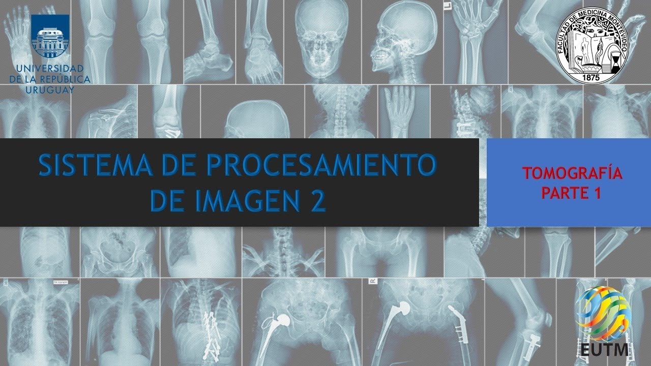 TOMOGRAFÍA PARTE 1