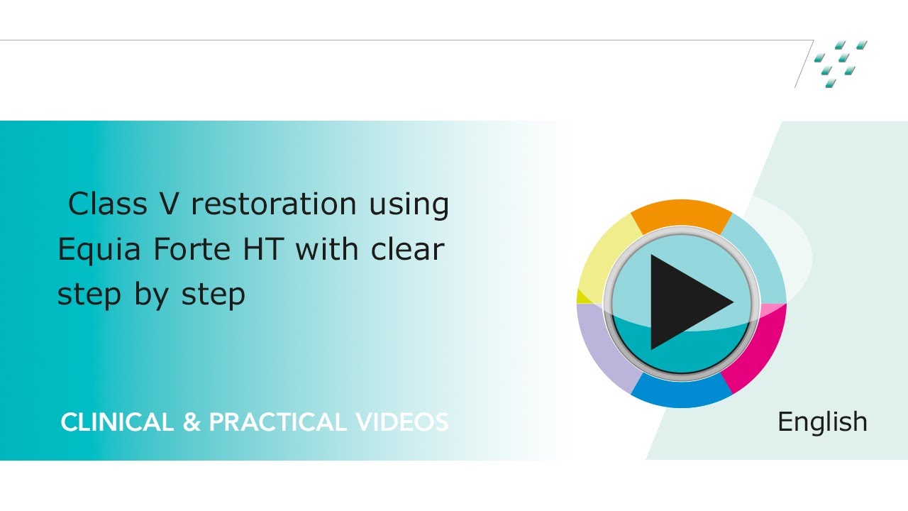 Class V restoration using EQUIA Forte HT with a clear step-by-step