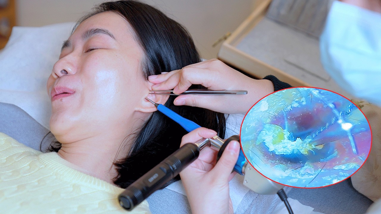 ASMR Visual Ear Cleaning & Blackhead Removal (So Satisfying & Real Sounds)