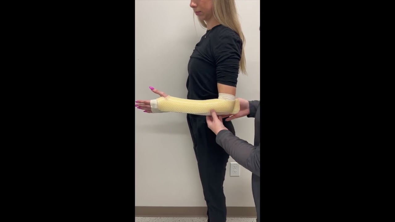 How to Fabricate a Muenster Orthosis (The Best Way to Fabricate a Muenster Orthosis!)