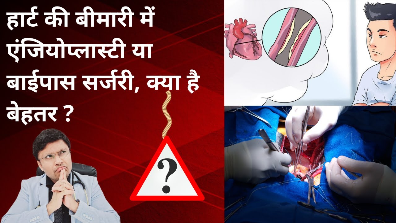 Angioplasty vs Bypass Surgery:-Which is better and why