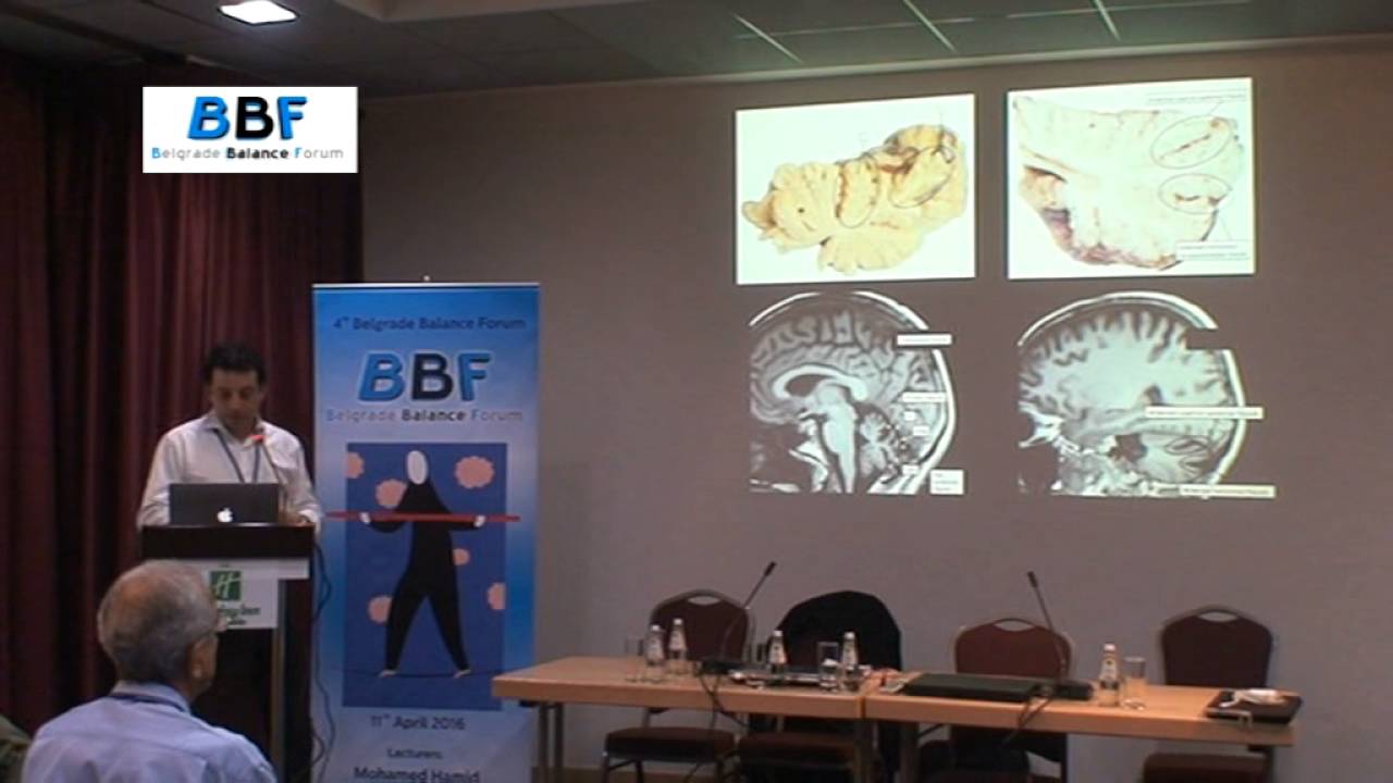 CANVAS David Szmulewicz BBF 2016