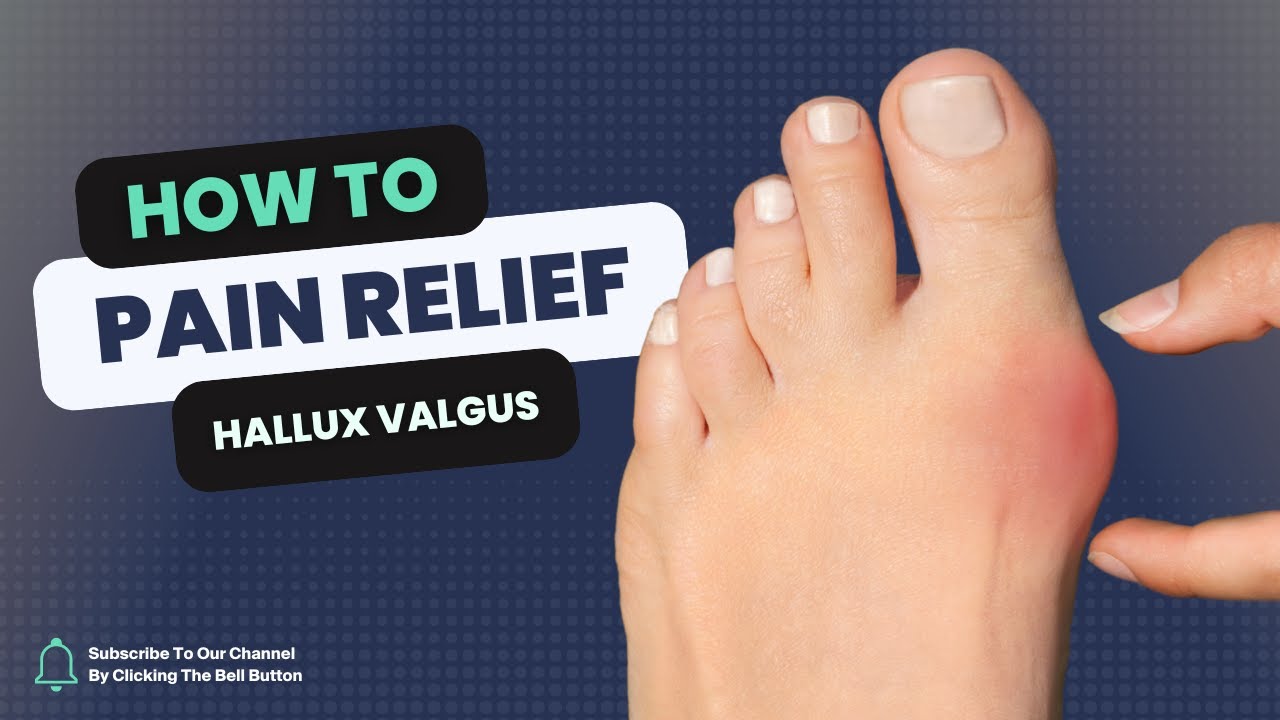 Straighten Your Toe: A Guide To Fixing Hallux Valgus