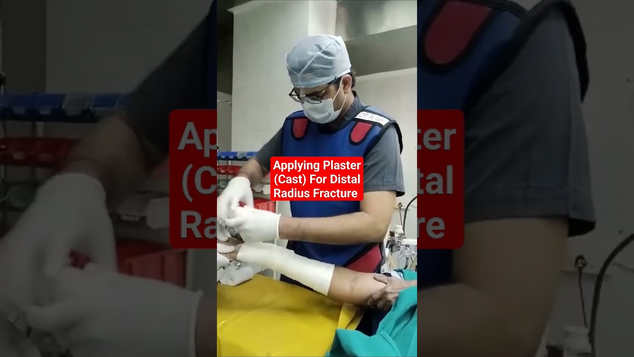 Applying Plaster (Cast) Distal Radius Fracture...Dr Sai Chandra..Knee n Shoulder Surgeon Hyderabad