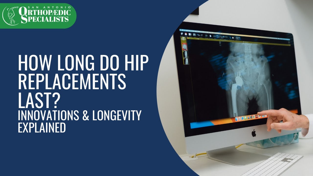 How Long Do Hip Replacements Last? #hipreplacement