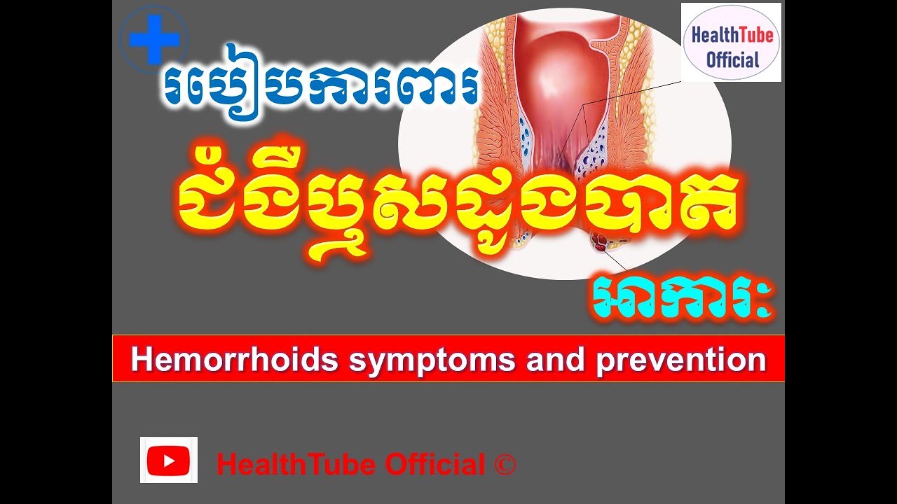 ជំងឺឬសដូងបាត អាការៈ និង របៀបការពារ l Hemorrhoids symptoms and prevention ll HealthTube Official
