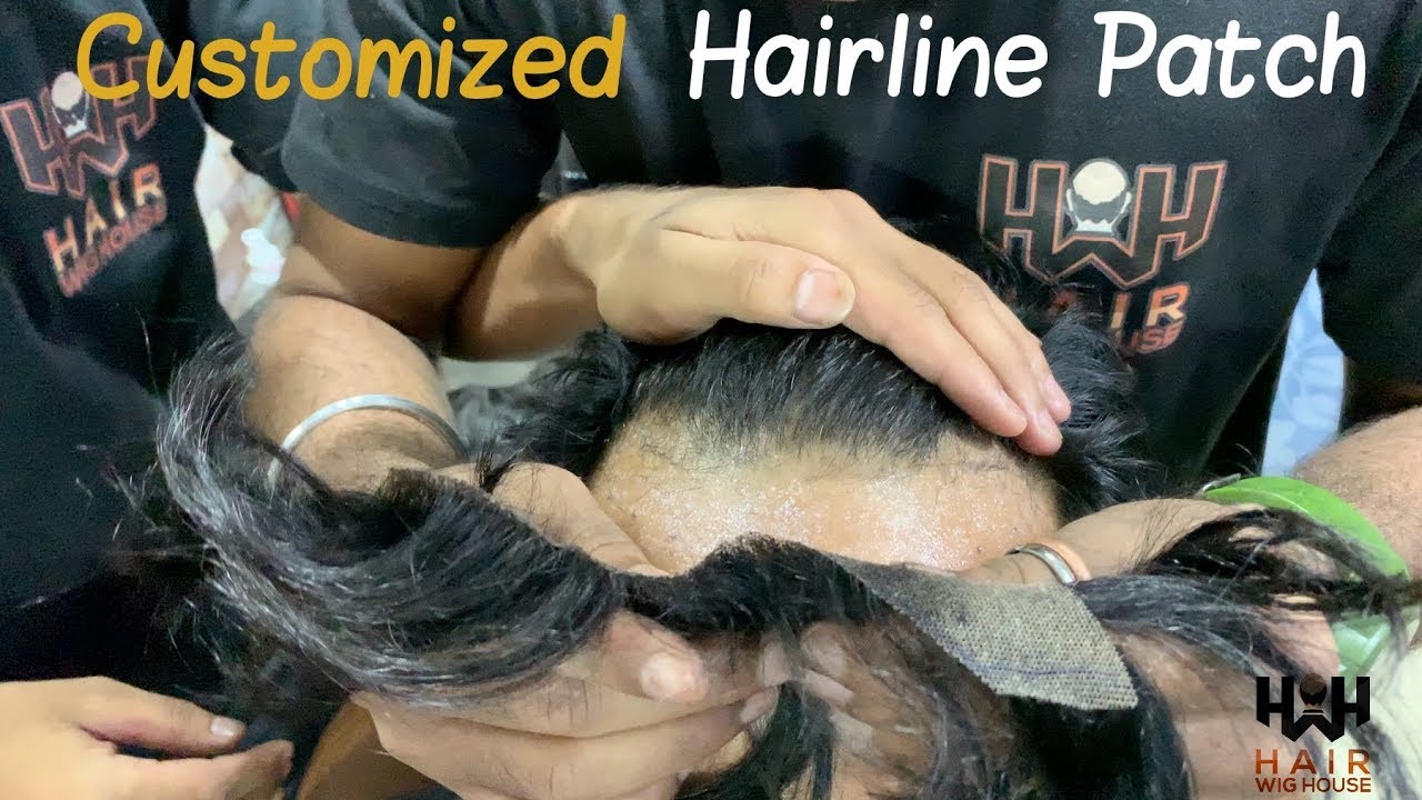 Customized Hairline Patch / हेयर लाइन पैच For Front | Hair Wig House | 9953384242