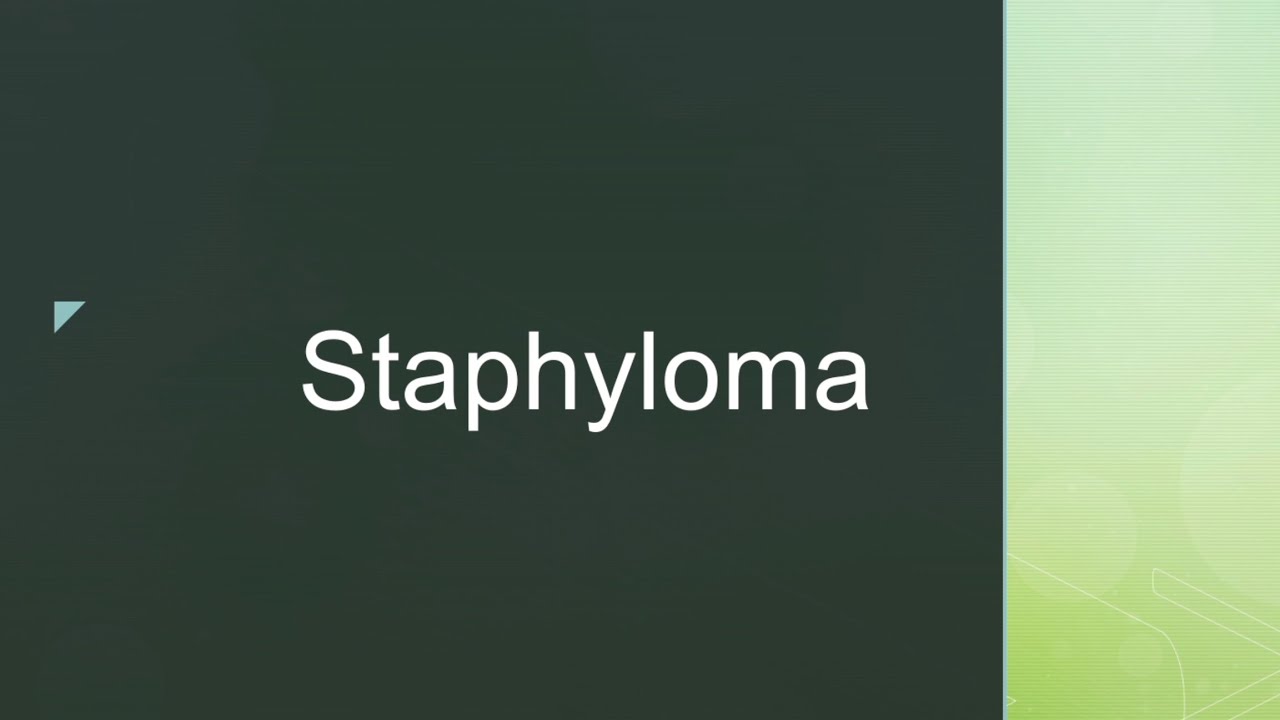 Staphyloma - Definition , types and treatment | Optometry desk (Tamil)