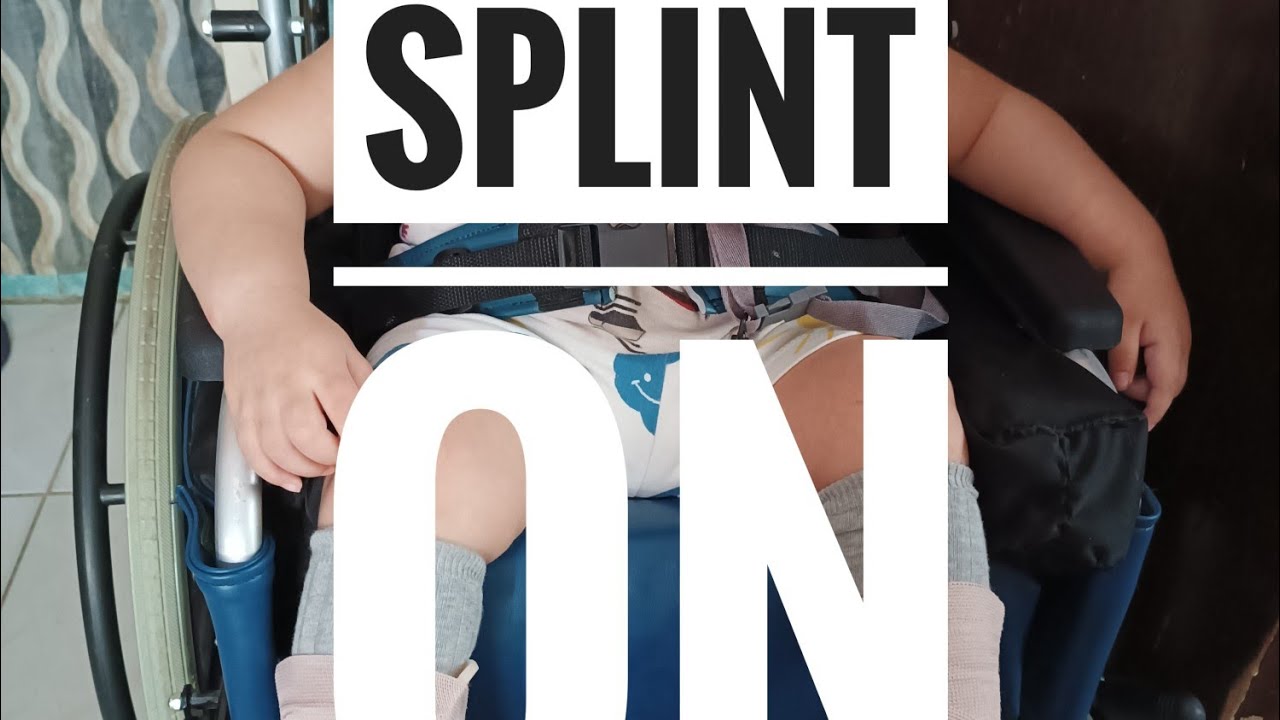Splint ni Dylan #cerebralpalsyawareness #youtubevideo 