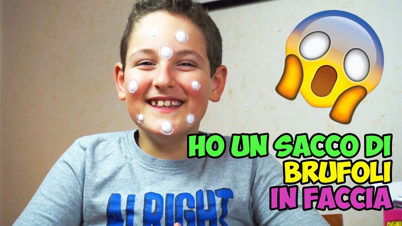 AIUTO ho un sacco di brufoli in faccia!!! I Brufolotti in EDICOLA