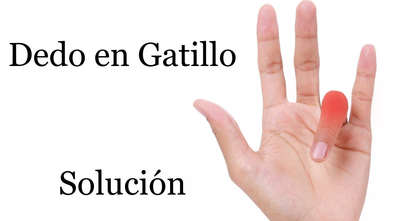 Dedo en Gatillo o Resorte Solución Rutina de Maniobras