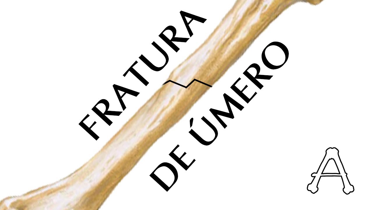 FRATURA DE ÚMERO COM LESÃO NERVOSA - Anatomia e clínica