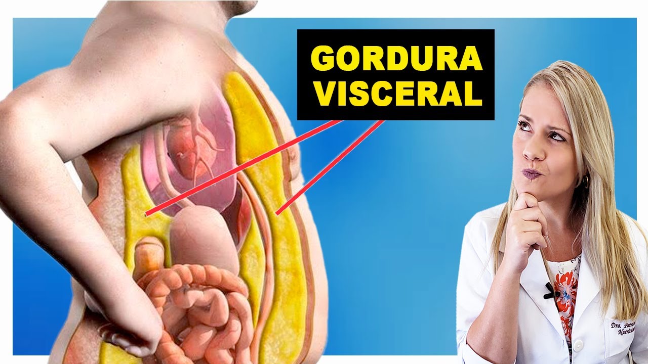 Como Perder Gordura Visceral Rápido - DIMINUA A BARRIGA!