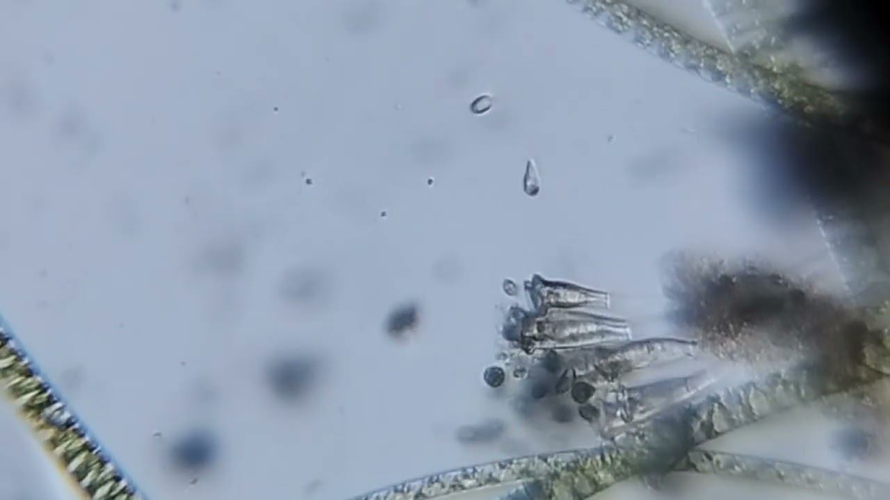 Protozoi ciliati,  genere EPISTYLIS? con peduncoli rigidi.