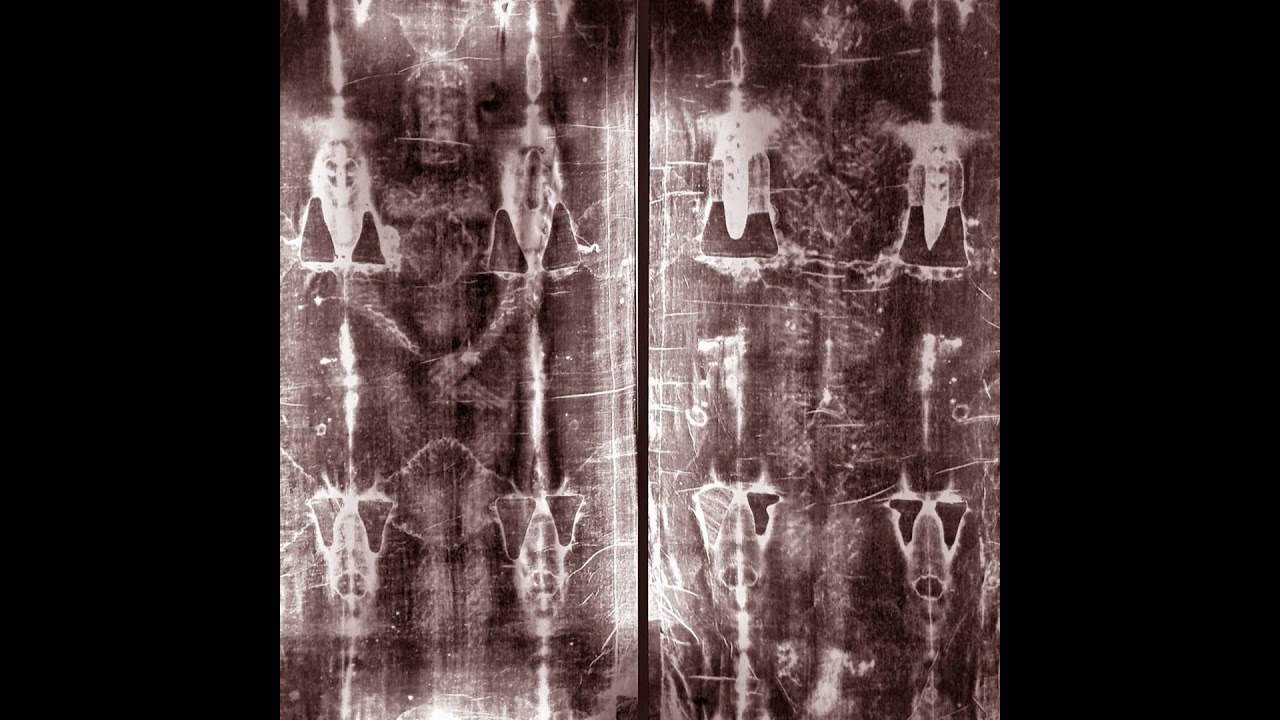THE SHROUD OF TURIN: IS THIS THE BURIAL CLOTH OF JESUS?