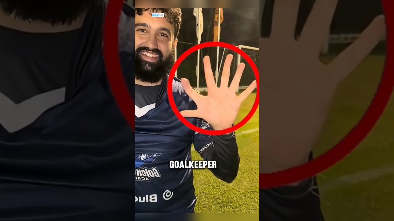 12 Fingers, 0 Mercy 😳🧤 The Goalkeeper They Called a Cheat!#FootballMagic ⚽#GoalkeeperLife 🧤#soccer