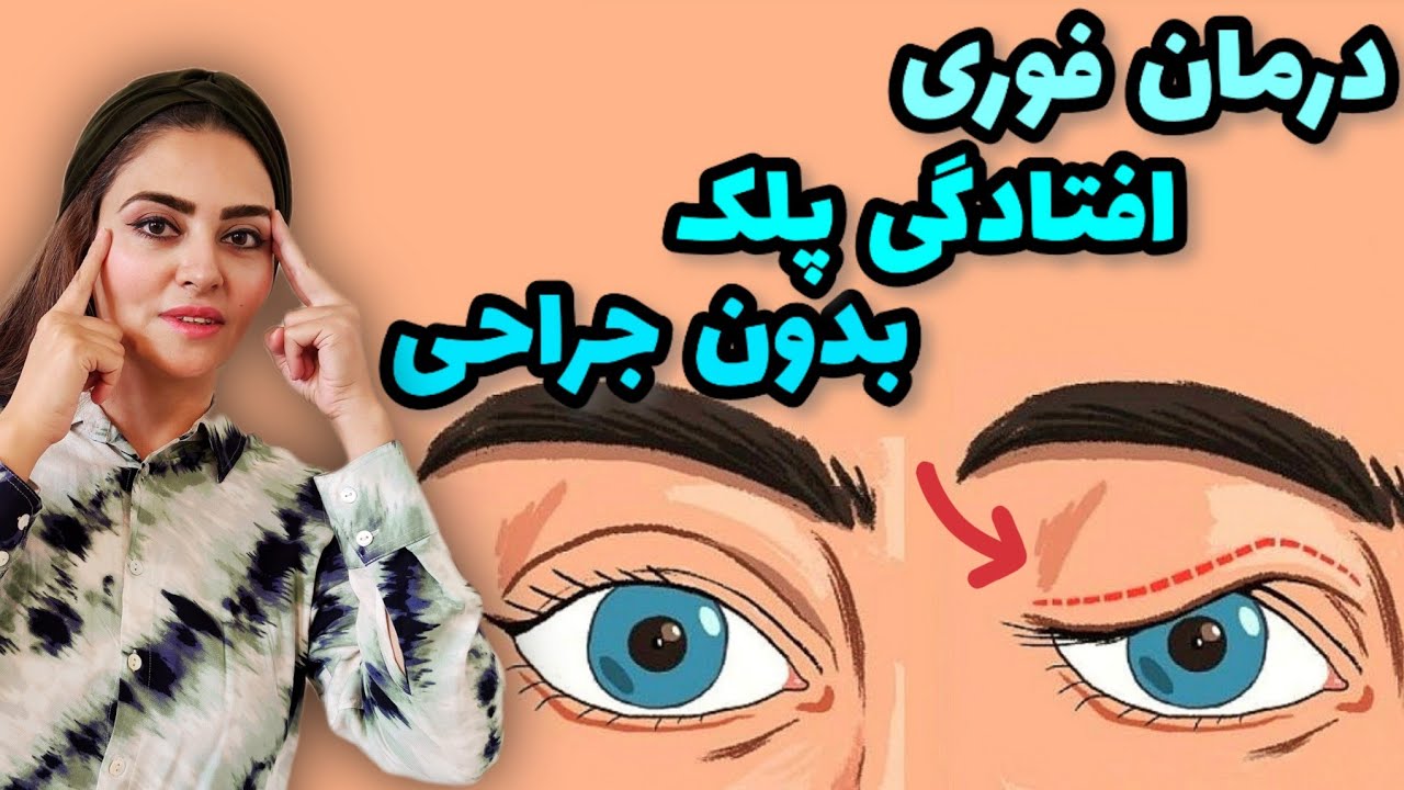 درمان افتادگی پلک بدون جراحی با یوگای صورت