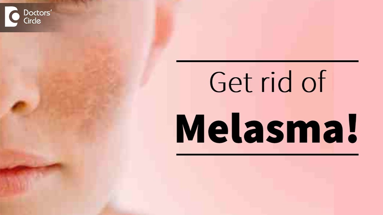 Melasma or pigmentation of skin. Treatment available? - Dr. Deepak P Devakar