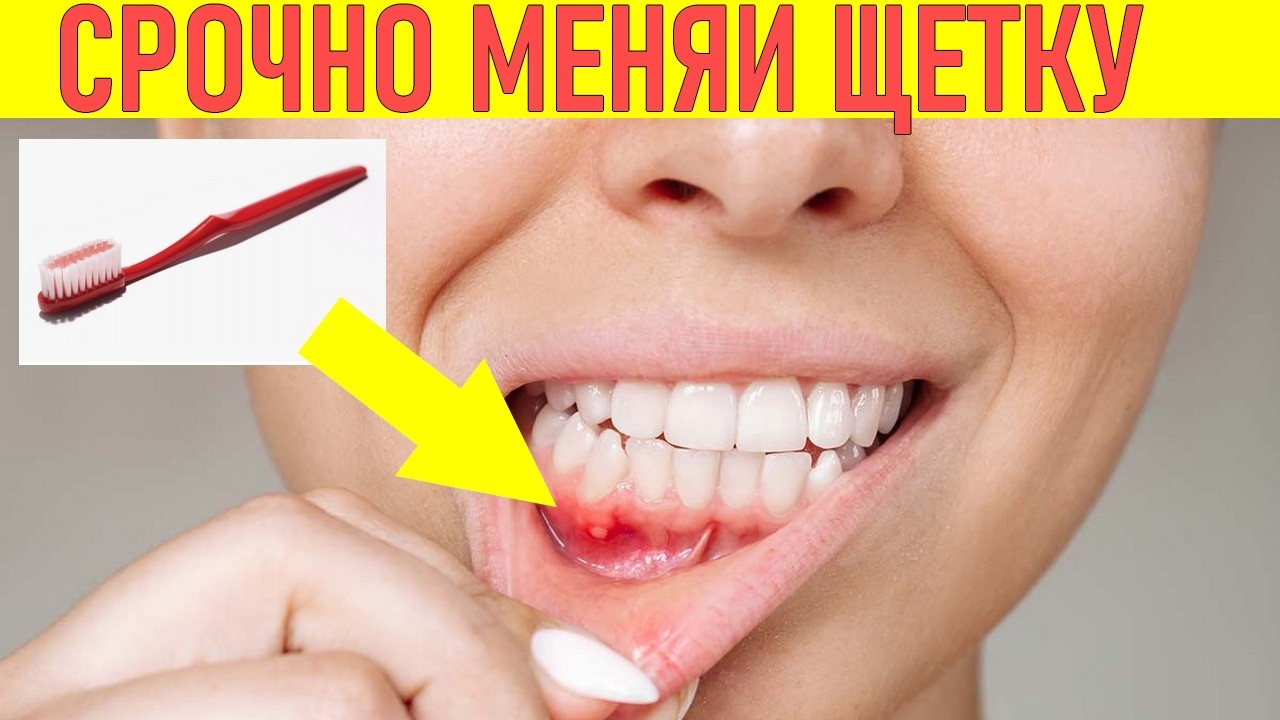 СРОЧНО МЕНЯЙ ЗУБНУЮ ЩЕТКУ | Как часто менять зубную щетку