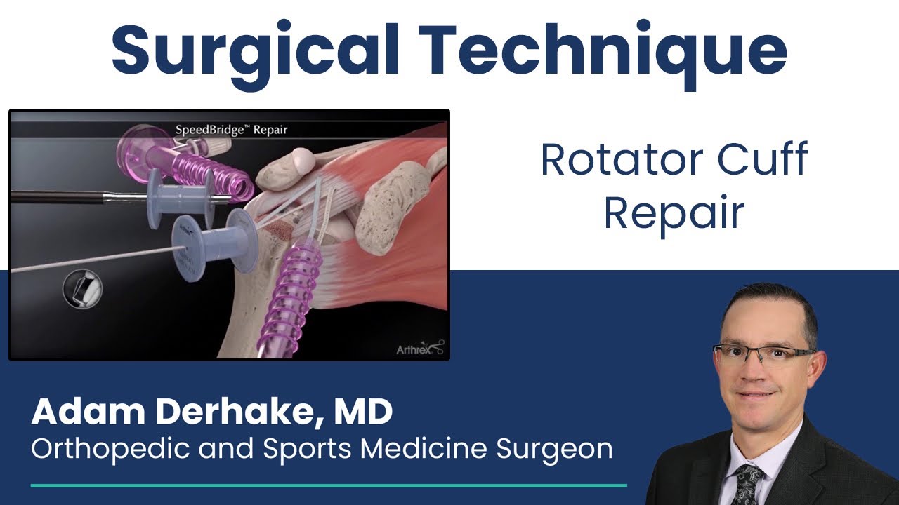 Rotator Cuff Repair:  Surgical Technique