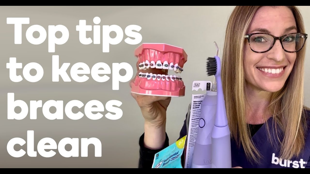 Top oral care tips while you're in braces