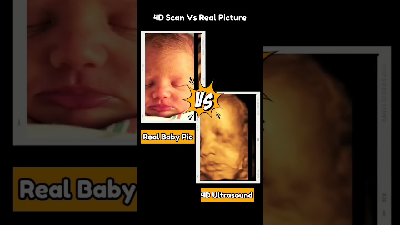 4D Baby Scan Vs Real Life 😍💯 