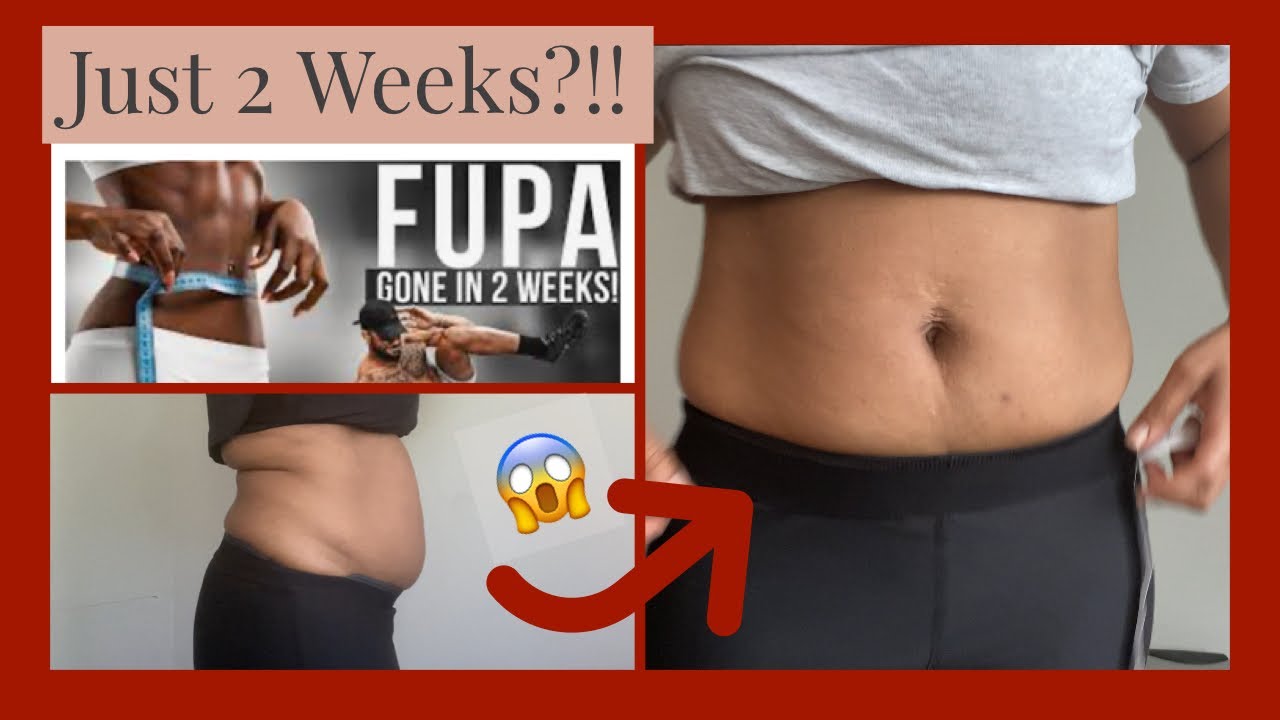 I did Mr. London FUPA Gone In 2 Weeks Challenge and here are my results!