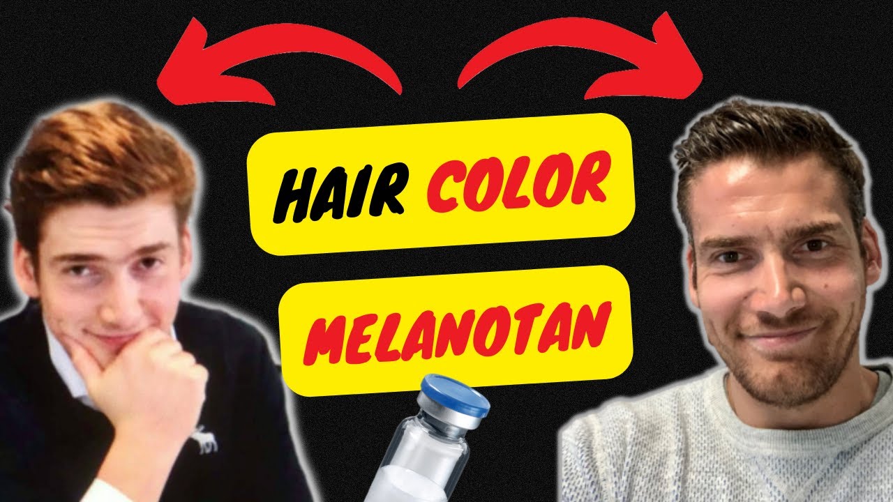 How melanotan changed the color of my hair permanently