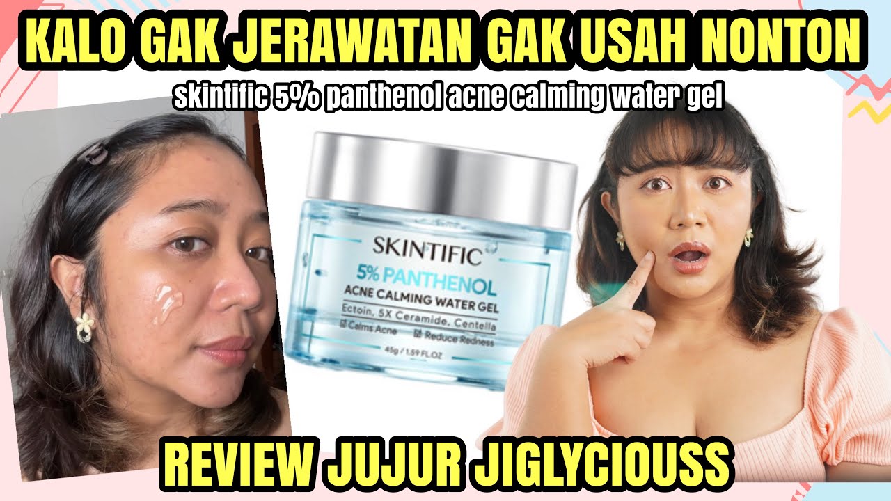 REVIEW JUJUR SKINTIFIC 5% PANTHENOL ACNE CALMING WATER GEL SETELAH PEMAKAIAN 1 BULAN