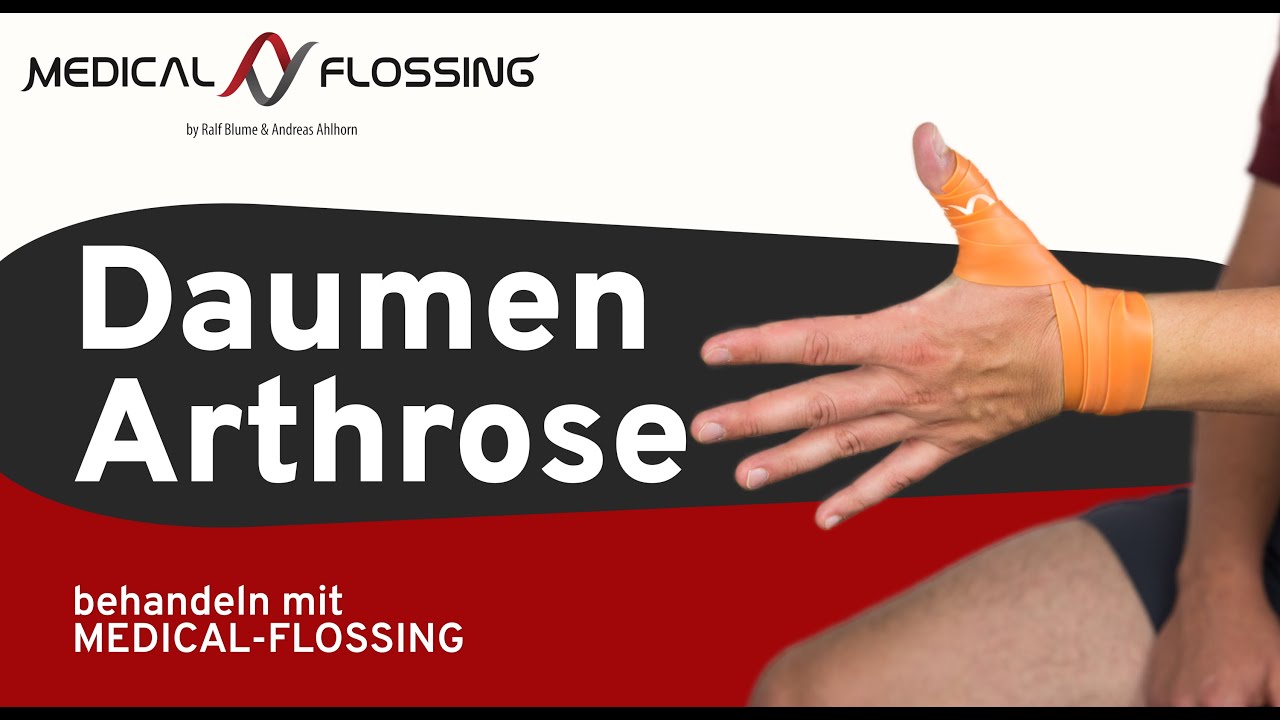Arthrose im Daumen  (Rhiz-Arthrose) - behandeln mit MEDICAL-FLOSSING !