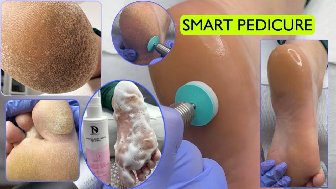 PEDICURE SMART | PODO DISC💿 | SCHIUMA Emolliente | SPA | DIANA NAIL SHOP
