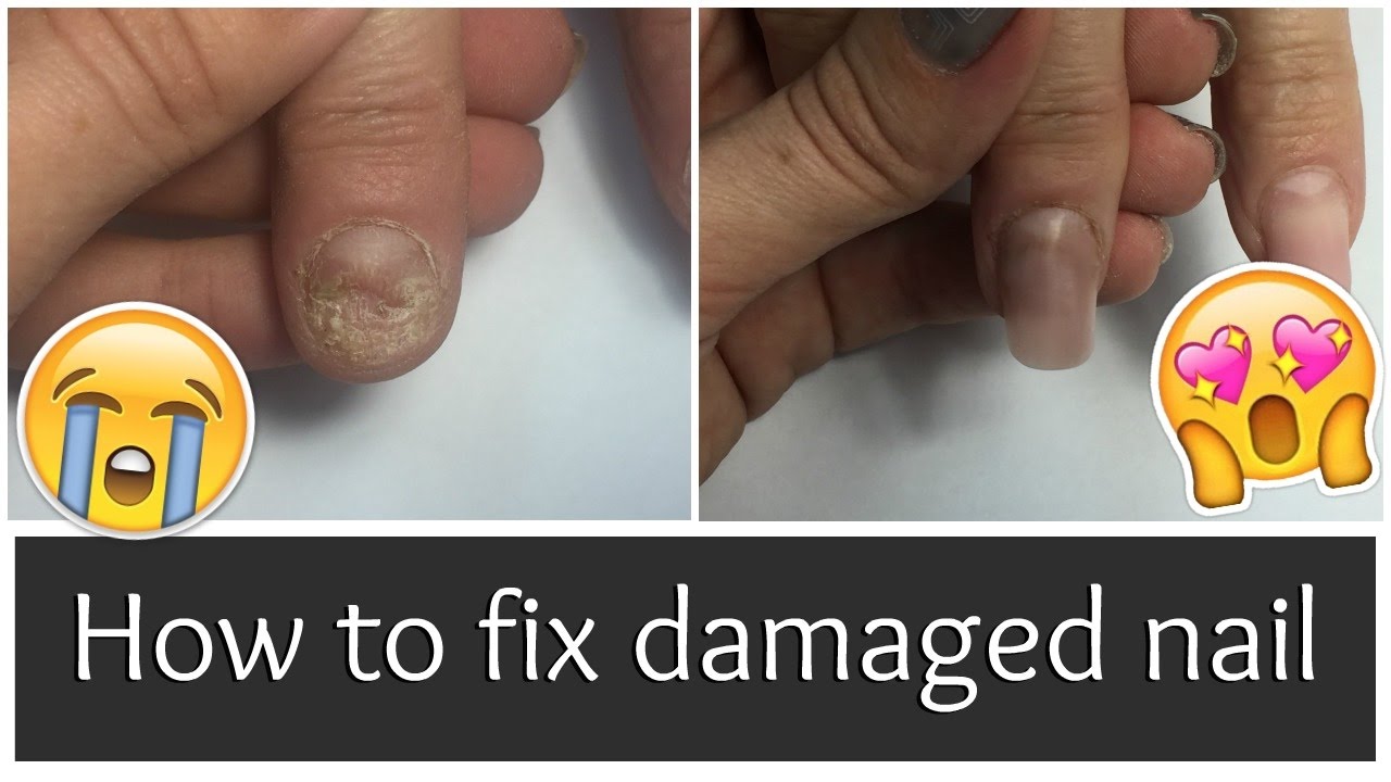 How to fix damaged nail | Acrylic sculpting tutorial | nailcou
