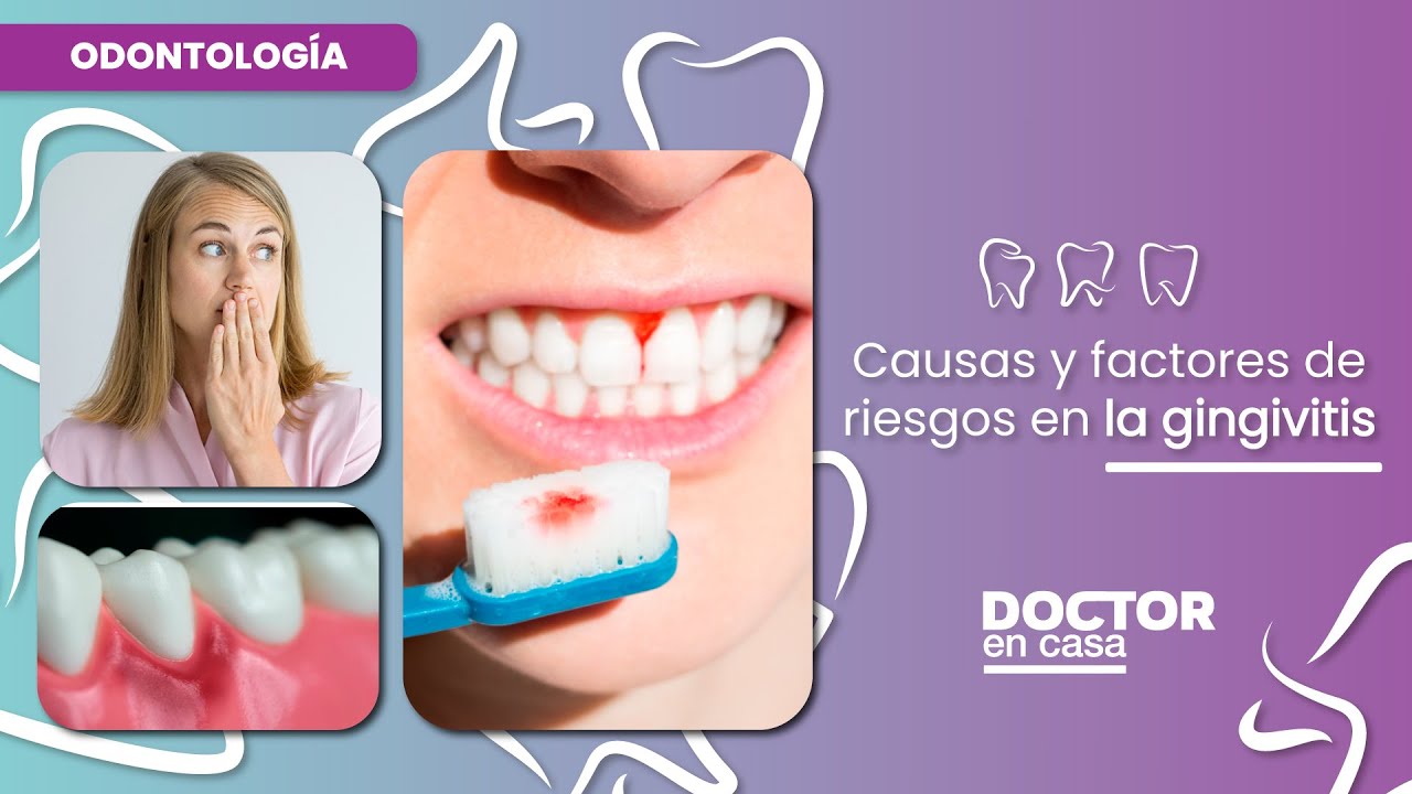Causas y factores de riesgo en la gingivitis