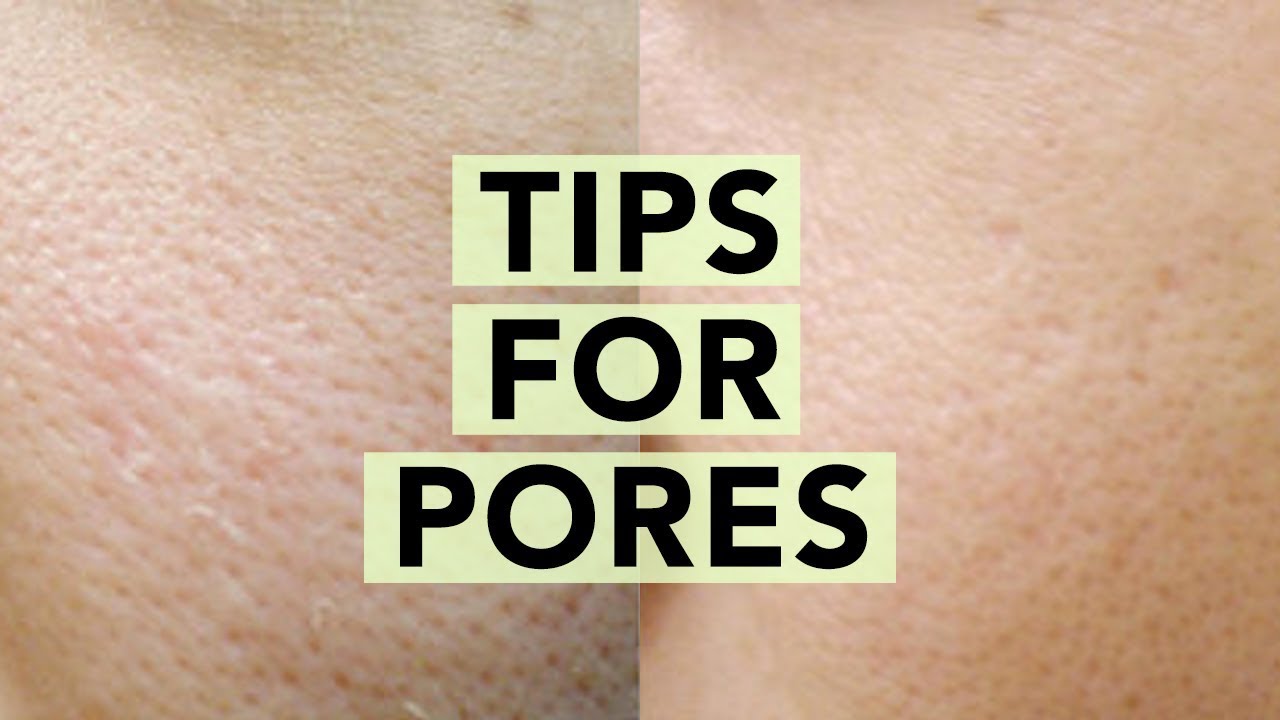 👃How To Minimize Large Pores • Skincare Solutions for Clogged Pores & Blackheads