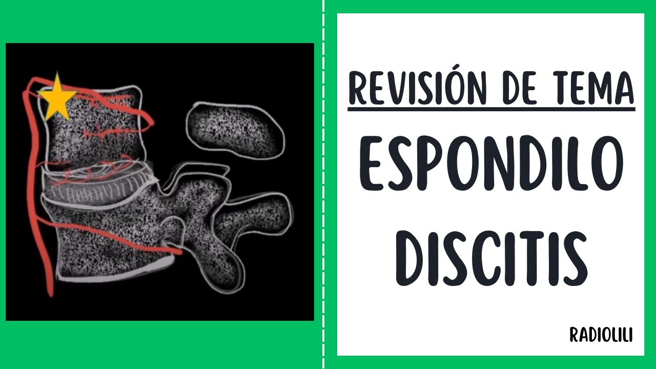 Espondilodiscitis: Revisión de Tema.