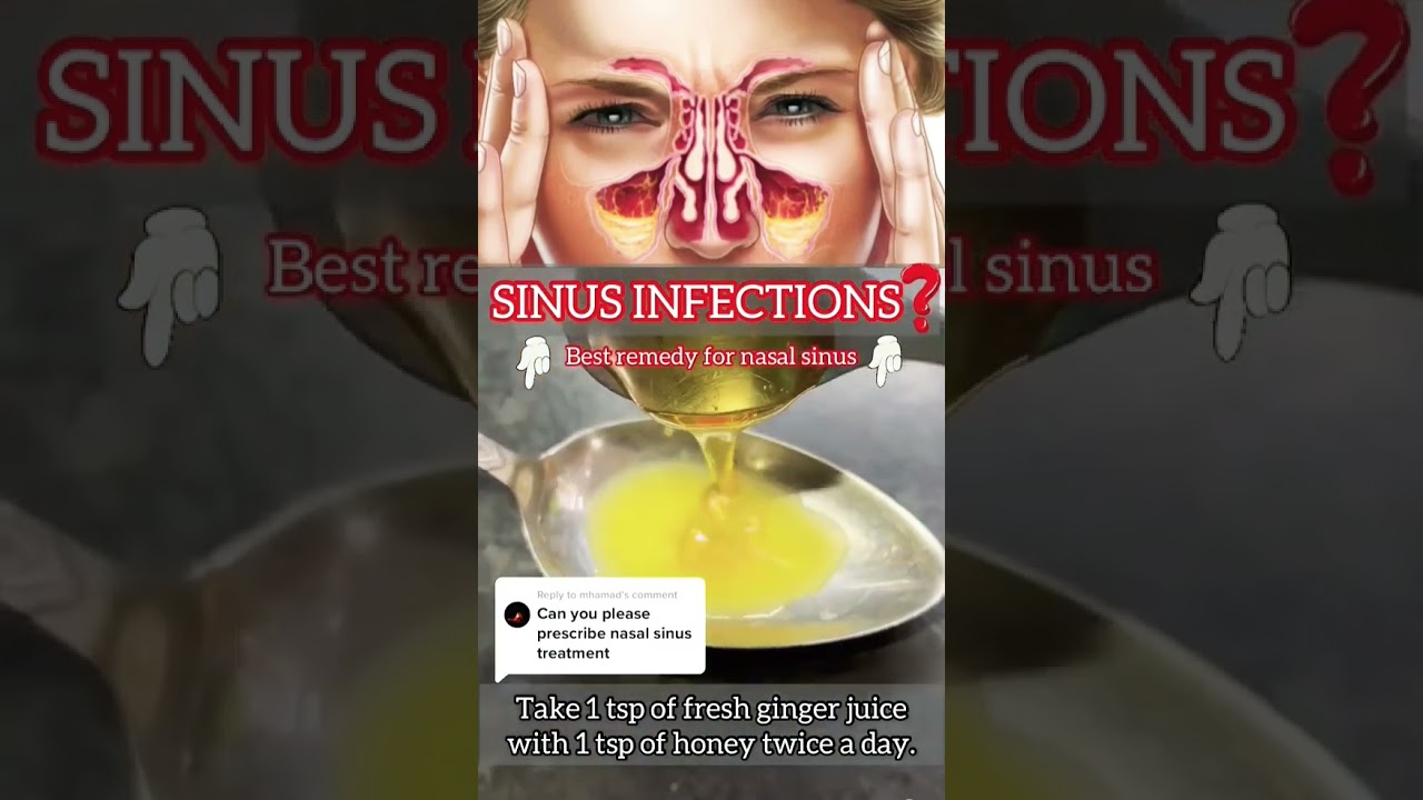 Sinus Infections best remedy for nasal sinus #beauty#beautyhack #healthy#everyone #healthylifestyle