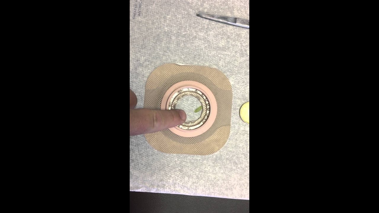 OSTOMY FLANGE CUTTING