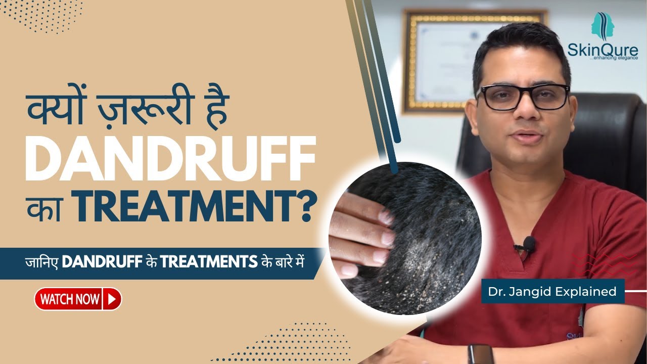 Why is it necessary to treat dandruff? | Dandruff Treatment in Delhi | Dr Jangid
