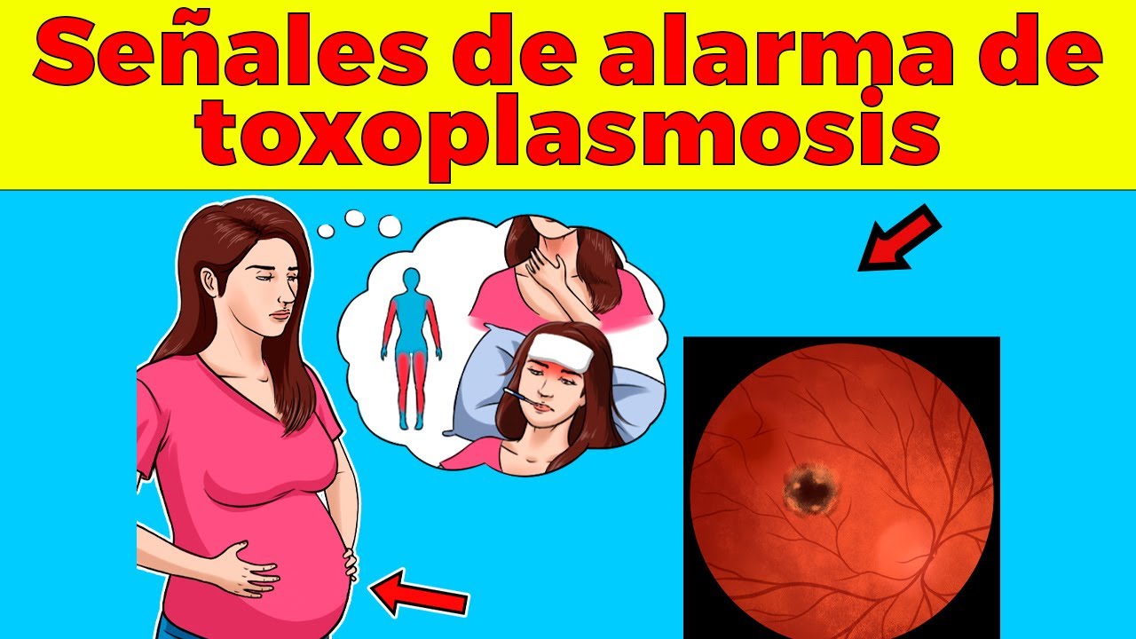 Síntomas de alarma de toxoplasmosis