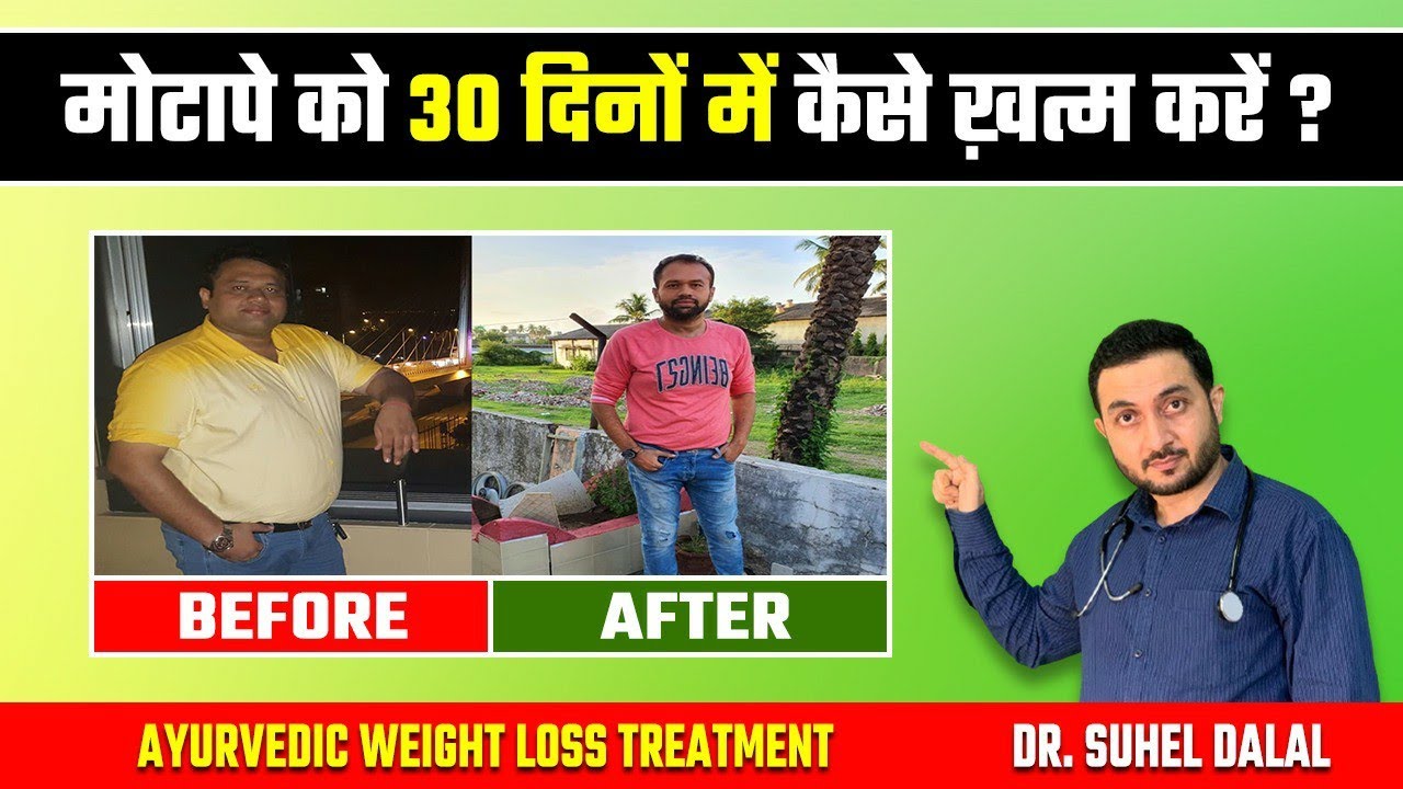 Motapa kam karne ka tarika | How to Lose Weight Fast | Obesity Treatment in ayurveda|Dr.Suhel Dalal