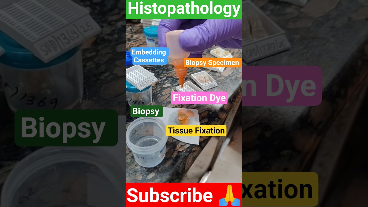 Histopathology fixation ✓ Biopsy Fixation Grossing 
