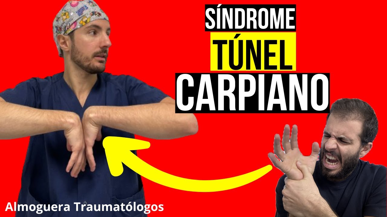 Se me duerme la MANO por la noche y tengo CALAMBRES ¿Cómo se CURA el TUNEL del CARPO?