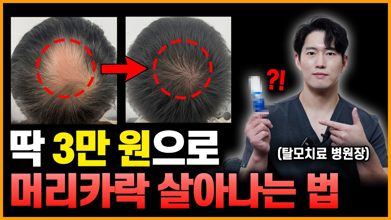 단돈 3만 원으로 머리카락 살아나는 법 (이인재 원장님)