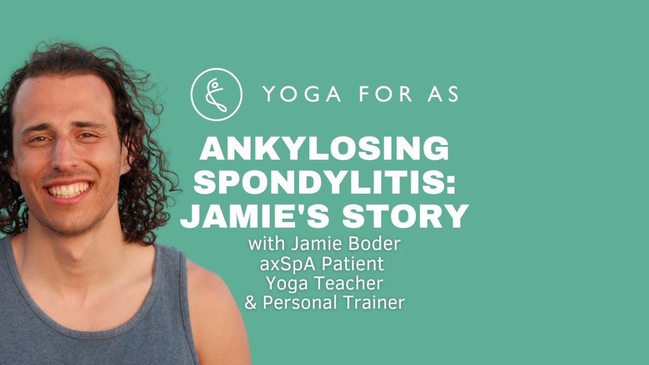Ankylosing spondylitis: Jamie's story