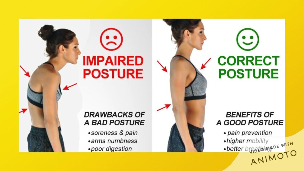 Melva mitchell fort worth common postural errors