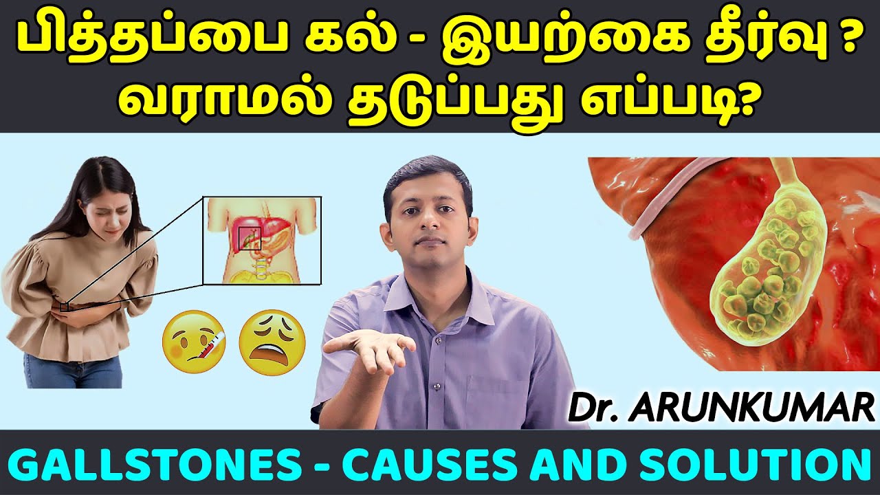 Gallstones – causes and dietary solution | பித்தப்பை கல் – காரணமும் தீர்வும் | Dr. Arunkumar