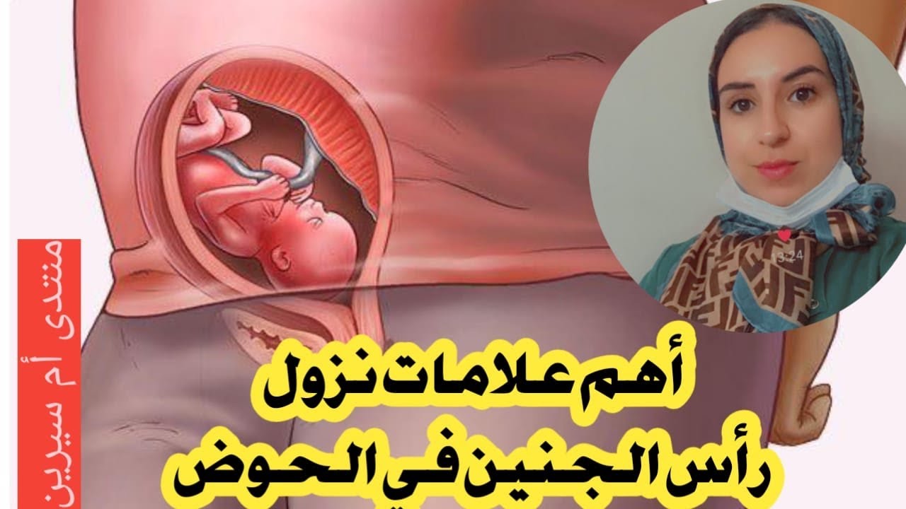 أهم علامات نزول رأس الجنين في الحوض 👌وماذا يحدث ان لم ينزل في الوقت المناسب ⁉️