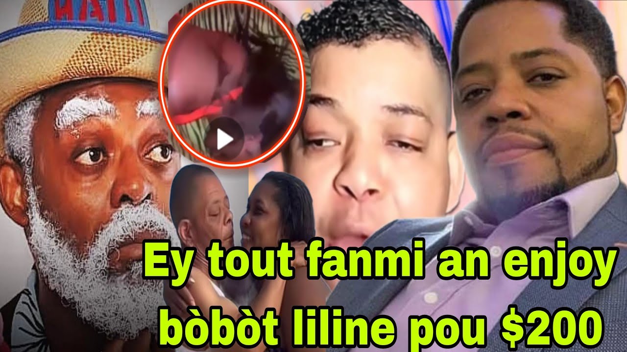 Tonton dezirab pale nan kozea Foto bobot liline se tt fanmi blan ki konn gade,sa lèd pou fanmi Rosin