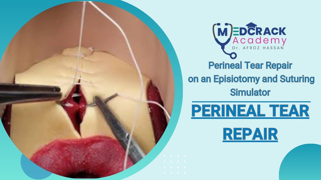PERINEAL TEAR REPAIR
