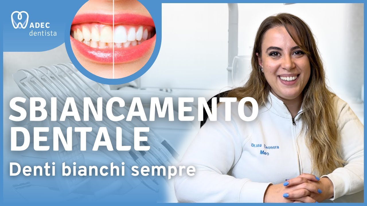 Sbiancamento: come avere denti bianchi sempre | ADEC Dentista a Milano